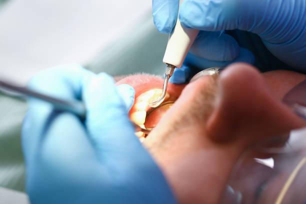 Best Weekend Emergency Dental Services in Ladoga, IN