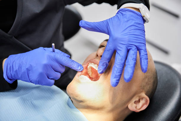 Best Dental Abscess Treatment in Ladoga, IN